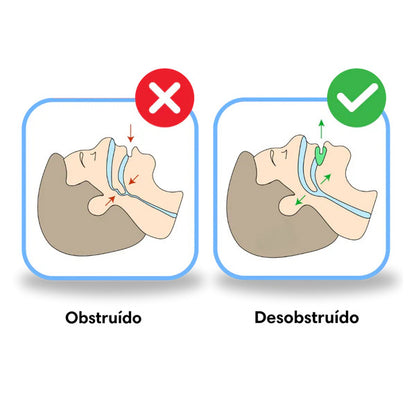 Antironquidos Protector Bucal Descanso